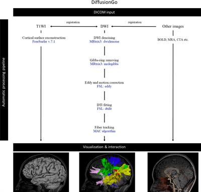 Automatic bundle-specific white matter fiber tracking tool using diffusion tensor imaging data: A pilot trial in the application of language-related glioma resection